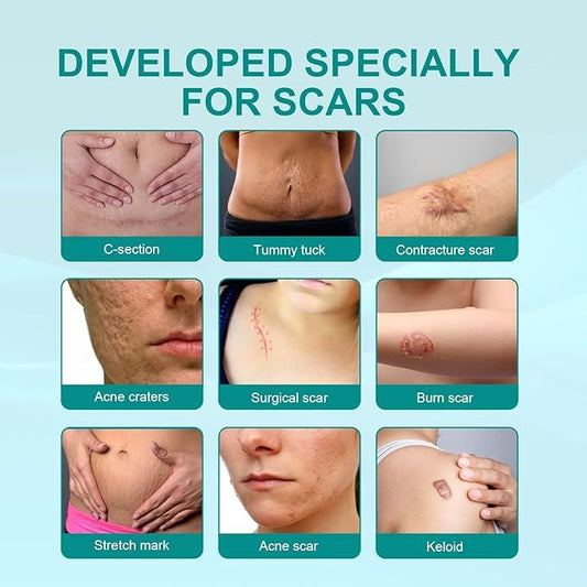 Proregen Medical Scar Removal Spray